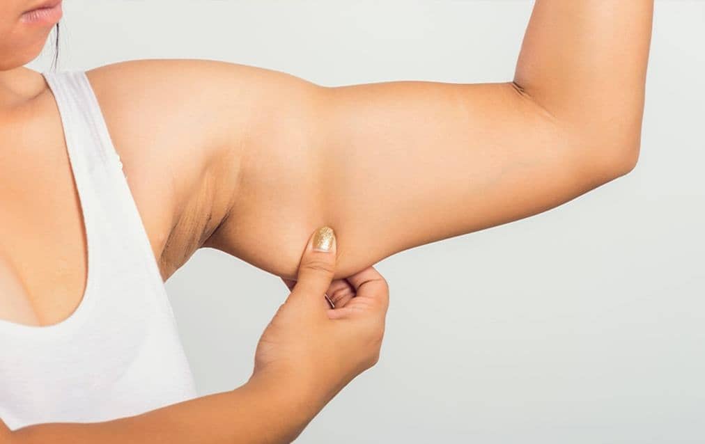 Botched Arm Liposuction