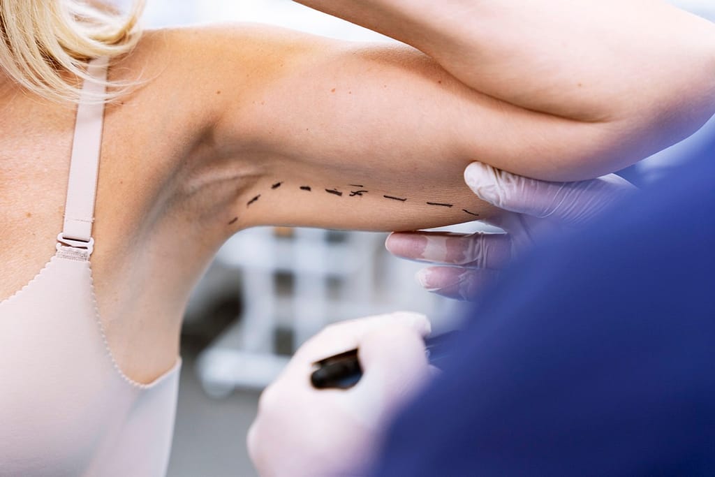 arm lift surgery close up patient appointment