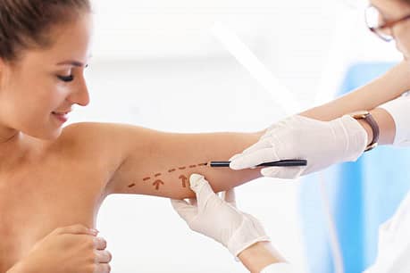 Picture of plastic plastic surgeon making marks on patient's body