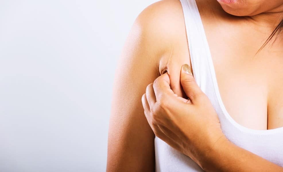 Armpit Liposuction Near Me